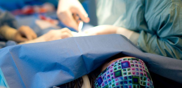 Ärzte fordern das Aus Beschneidung eines kleinen Jungen. An der seit einem Jahr bestehenden gesetzlichen Regelung gibt es immer noch Kritik.