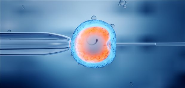 Die intrazytoplasmatische Spermieninjektion (ICSI) kann Paaren zu einem Kind verhelfen, wenn der Mann defekte Spermien hat.