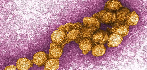 Dieses von den Centers for Disease Control zur Verfügung gestellte Foto aus dem Jahr 2012 zeigt eine elektronenmikroskopische Aufnahme des West-Nil-Virus.