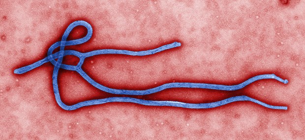 Ebola-Ausbruch in Uganda Ebola in Farbe: Eine Epidemie des Filovirus in Uganda hat 14 Menschen das Leben gekostet.