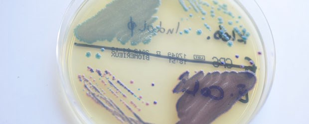 Mehr Erreger sollen ins Gesetz E.coli und K.pneumoniae: Auch sie sollen verstärkt ins Visier genommen werden.