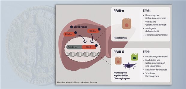 Iqirvo – neue Therapieoption in der Zweitlinie bei primär biliärer Cholangitis Elafibranor ist ein dualer Agonist der PPAR- und - und moduliert den Gallensäurestoffwechsel  Ipsen Pharma GmbH