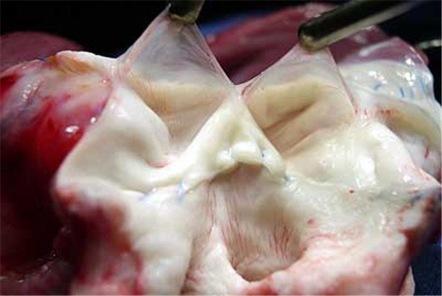 Herzklappen aus eigenen Zellen bald möglich? Gezüchtete Herzklappe aus Zellen eines Schafs sechs Monate nach der Implantation. Die beiden Herzklappensegel sind frei von Thromben und Kalzifizierungen.