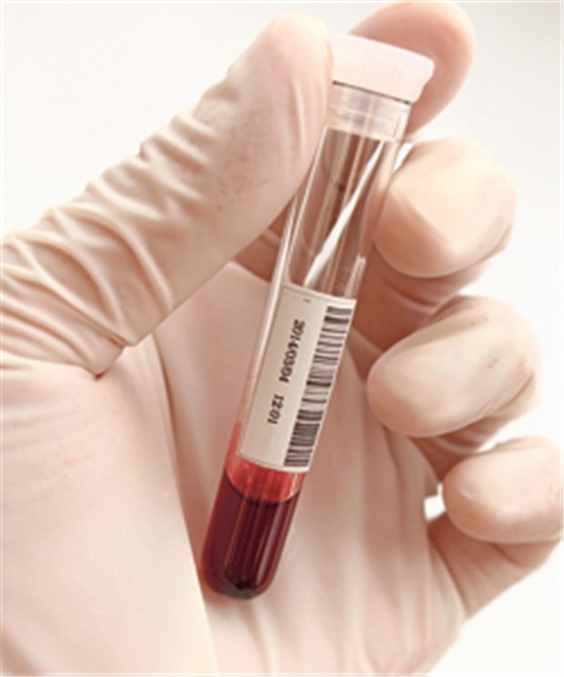 Neuer Test scannt Blut auf Hunderte Viren Im Blut der Probanden entdeckten die Forscher im Schnitt Antikörper gegen zehn Virusarten.