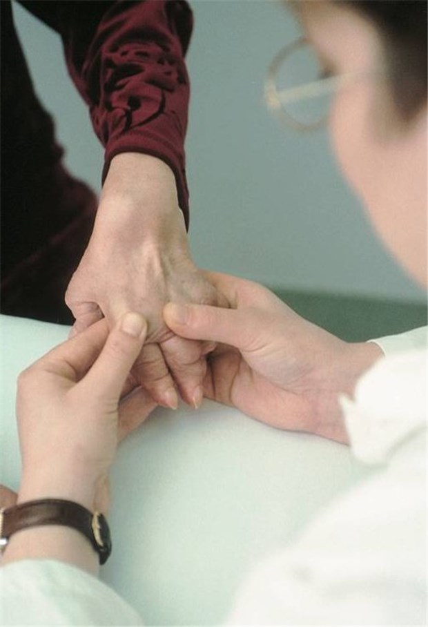 Kosten senken bei der Arzneitherapie von Rheuma-Patienten - das ist ein Holzweg Kontrolle der Finger-Grundgelenke einer Patientin: Die Kosten der Arzneitherapie steigen.