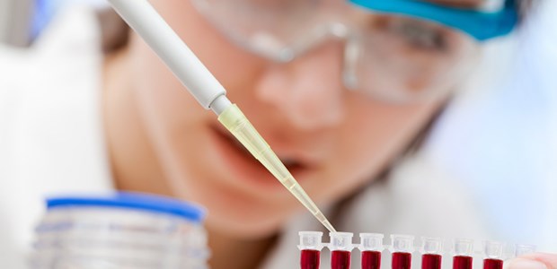 Prognose mit Krebszellen Mit Hilfe von Blutproben lässt sich die Minimale Resterkrankung bei CLL quantifizieren.