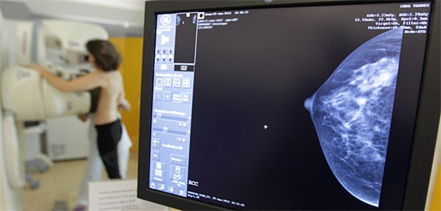 'Die meisten Frauen haben keinen Vorteil' Mit Mammografie von 1000 Frauen lassen sich ein bis zwei Brustkrebs-Todesfälle verhindern.