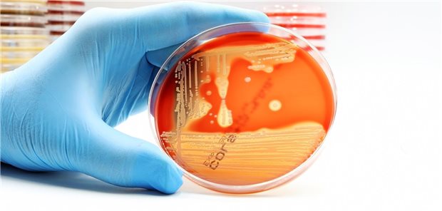 Multiresistente Keime wie Methicillin-resistenter Staphylococcus aureus (MRSA) gefährden die Gesundheit von Menschen in Gesundheitseinrichtungen.