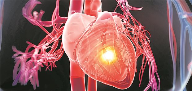 3D-Darstellung eines Herzens mit einem leuchtenden Punkt.