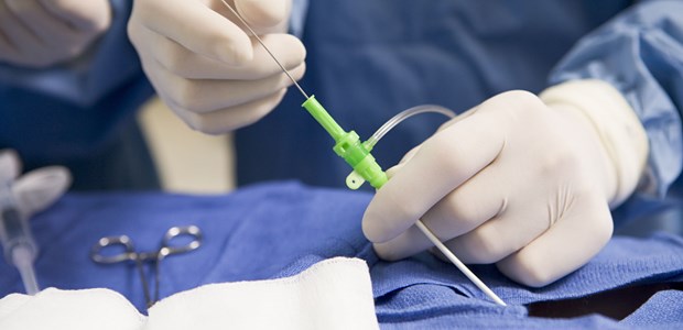 Nitrit reduziert nicht den Schaden PCI: Nitrit reduziert offenbar nicht den Reperfusionsschaden nach einem STEMI.