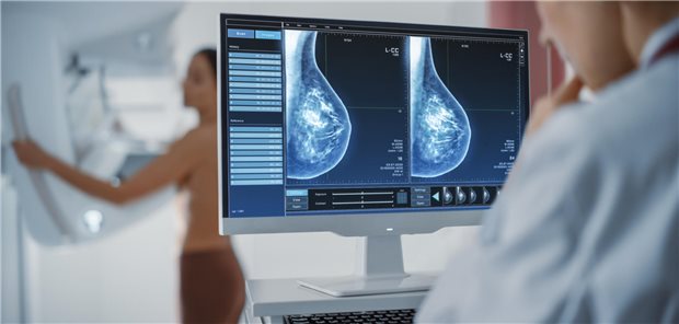 Patientin bei der Mammografie