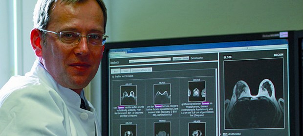 Die Bilderflut der Radiologen Professor Elmar Kotter, leitender Oberarzt der Radiologischen Uniklinik Freiburg, testet Radminer.