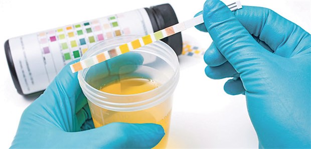 Antibiotika-Therapie auch bei Patienten ohne Symptome? Test auf Bakteriurie: Schwangere mit positivem Ergebnis sind auch bei Symptomfreiheit zu behandeln.
