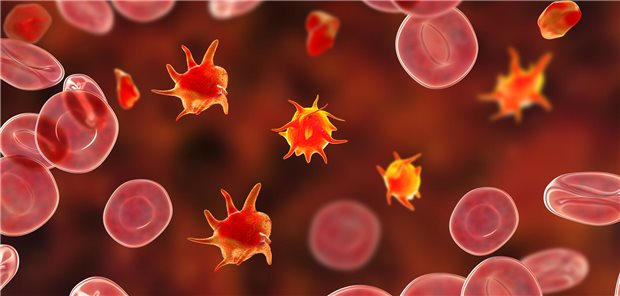 Thrombozyten und Erythrozyten: Chinesische Forscher haben untersucht, wie sich nach einer perkutanen Koronarintervention Blutungen reduzieren lassen.