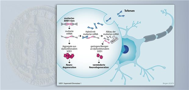 Qalsody™ – das erste Medikament zur zielgerichteten Behandlung einer genetischen Form der ALS Tofersen ist ein Antisense-Oligonukleotid, das an die mRNA des mutierten SOD1-Gens bindet. Es kommt zum RNAse-H1abhängigen Abbau der mRNA, was die Menge an schädlichem SOD1-Protein reduziert.  Biogen GmbH