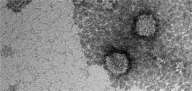 Transmission electron microscopy. Electron micrographs of purified viral particles of the Alongshan virus strain Miass527 propagated in IRE/CTVM19 cells