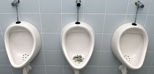 Schlecht eingestellte Diabetiker besonders gefährdet Typ-2-Diabetiker in einer Studie hatten im Vergleich zu Nicht-Diabetikern ein 2,4-fach erhöhtes Risiko für Nierensteine.
