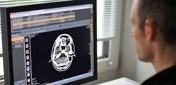 Der ungenutzte Helfer Unterstützung etwa bei der Diagnose von Kopfverletzungen können sich Hausärzte per Telekonsultation in Kliniken einholen. In einigen regionalen Ärztenetzen werden solche Lösungen längst genutzt.