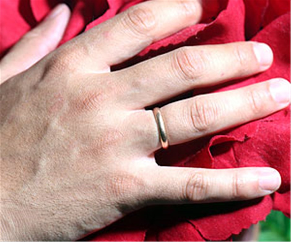 So kriegen Sie den Ring vom Finger