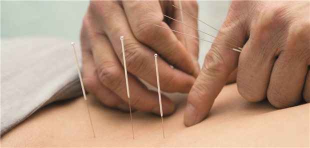 Wird immer wieder von Patienten nachgefragt: Akupunktur bei Schmerzen.