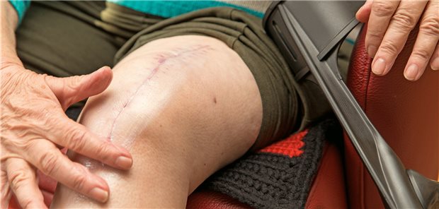 : „Narbe nach Kniegelenkersatz: Künftig können sich Kassenpatienten vor der Op eine Zweitmeinung einholen.“