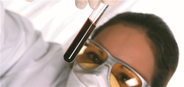 1000 Euro für zusätzliche Schutzkleidung, Trennwände und ähnliches sind in Praxen durch die Pandemie entstanden. Das deutet ein erster Trend der aktuellen Zi-Befragung an.