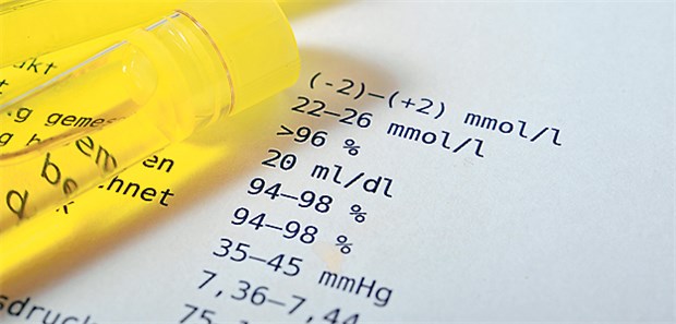 Labore haben gute Chancen 19 Prozent Mehrwertsteuer auf Laboranalysen? Die Zeichen verdichten sich, dass es damit bald ein Ende hat.