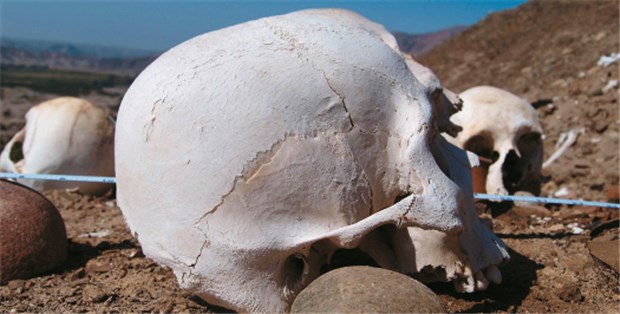 Zahnwurzeln als historische Fundgrube 2000 Jahre alt ist dieser Schädel aus Peru: Eine DNA-Analyse ergab, dass der Tote Syphilis im Endstadium hatte. © Fehren-Schmitz