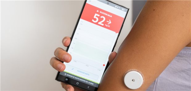Patient mit Hypoglykämie, der seinen Blutzuckerspiegel mit einem kontinuierlichen Blutzuckermesssensor und einer Smartphone-App überwacht.