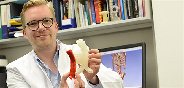 Herzgefäßprothese bald aus dem 3-D-Drucker? 3-D-Druck-Modell eines Gefäßaneurysmas (weiß) und der Form der späteren Gefäßprothese (rot) in den Händen von Dr. Nikolaus Thierfelder, Herzchirurg. Klinik u. Poliklinik, Klinikum der LMU München.