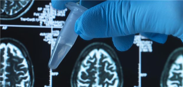 Bildgebung eines Gehirns. Davor hält jemand ein Tube mit einer durchsichtigen Flüssigkeit.