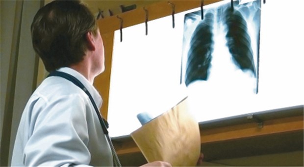 3,59 Euro für das QZV Röntgen - das ist nur noch die Hälfte dessen, was es in Brandenburg im Vorquartal für Teilradiologie gab.