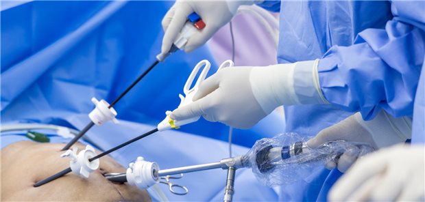 Nahaufnahme der Hände des Chirurgen-Teams während der Operation zur Entfernung der Gallenblase mit chirurgischen Laparoskopie-Instrumenten.