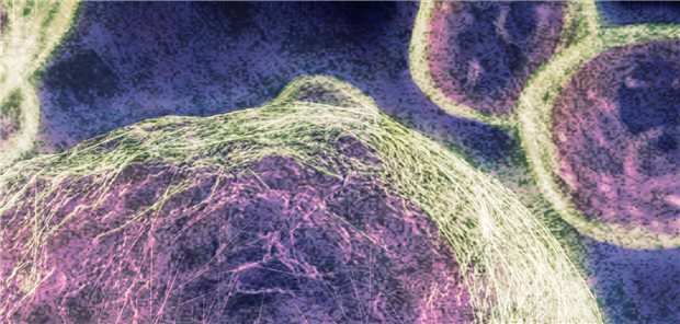 3D-Darstellung des Pilzes Pneumocystis jirovecii, früher Pneumocystis carinii genannt.