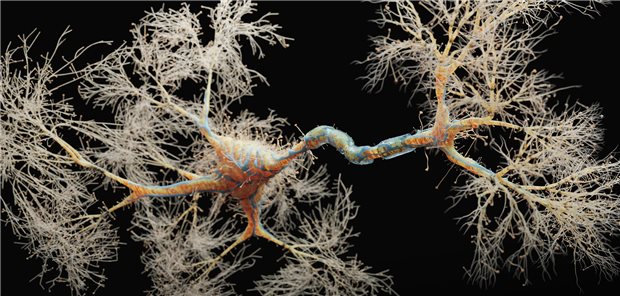 3D-Darstellung eines Neurons. Jetzt werden Auffälligkeiten im Zusammenhang mit erblicher spastischer Paraplegie untersucht.