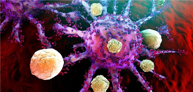 3D-Darstellung, wie T-Zellen des Immunsystems Krebszellen angreifen. Auch beim Mammakarzinom werden jetzt die Optionen der Immuntherapie geprüft.
