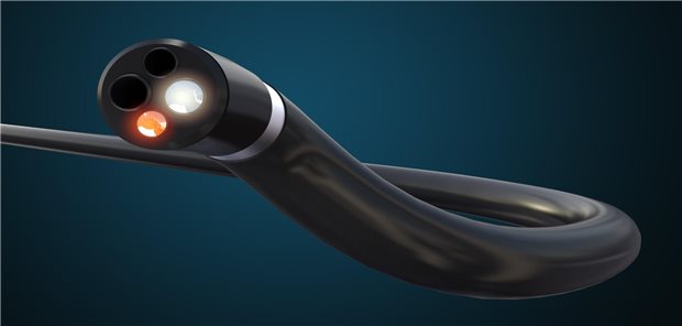 3D-Illustration eines Koloskops.