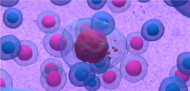 3D-Modell: Abnormale Plasma- oder B-Zelle bei Multiplem Myelom.
