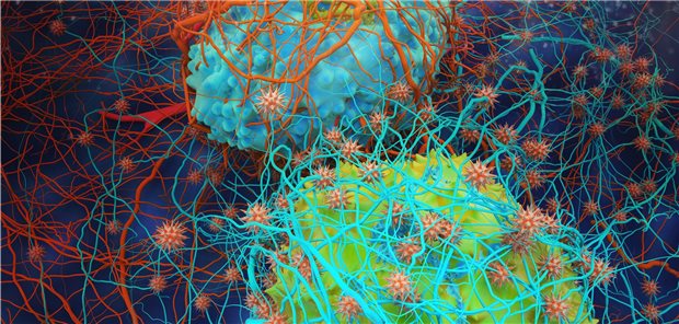 Häufige Tumor-Mutation entdeckt 3D-Rendering menschlicher Krebszellen.
