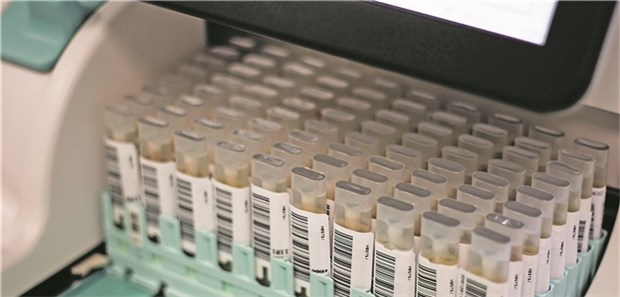 80 iFOBT-Proben auf dem Weg in den Laborautomaten.