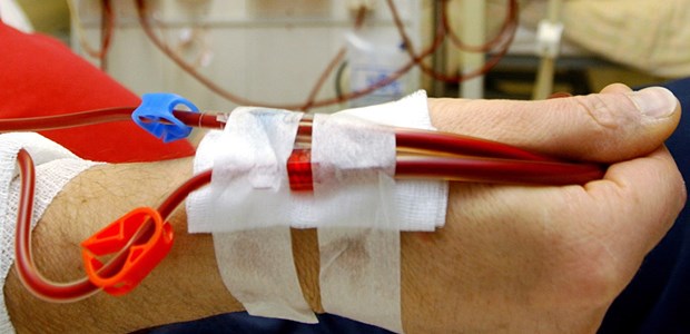 Die Finanzierung des KfH steht auf der Kippe 80.000 Bundesbürger sind dialysepflichtig. An den Ausgaben dafür wollen die Kassen jetzt 80 Millionen Euro sparen.