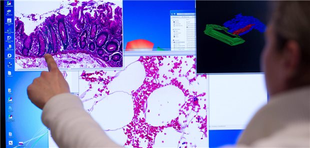 ARCHIV - Ein Mitarbeiter zeigt am 21.02.2014 im Institut der Pathologie der Universitätsklinik Charité in Berlin an einem Computerbildschirm auf eine Darstellung einer eingescannten Probe eines Stück Gewebes aus dem Dickdarm, das bei einer Operation entnommenen wurde. Das zu Vergrößerung eingesetzte „virtuelle Mikroskop“ ermöglicht den internationalen Austausch von Befunden bei der Krebs-Diagnostik in der Pathologie. Foto: Bernd von Jutrczenka/dpa (zu dpa „Berlin und Brandenburg bringen Krebsregister auf den Weg“ vom 29.11.2014)