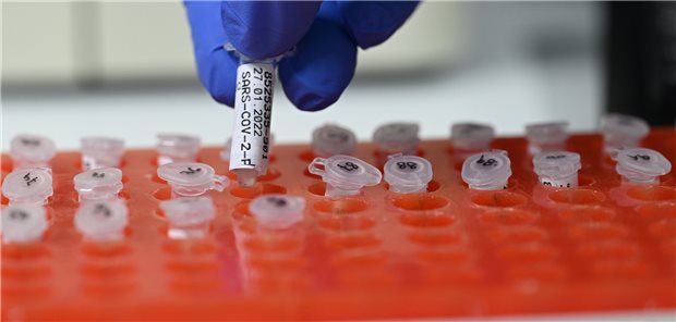 Ab nächstem Jahr startet auch in privaten Facharztlaboren die Ausbildung zu Medizinischen Technologen für Laboratoriumsanalytik. Noch ist unklar, wie die Vergütung der Ausbildungsaufwendungen für die Labore kompensiert werden sollen.
