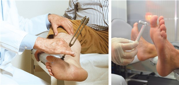 Abb. 1: Die Wahrnehmung von schwachen Reizen an den peripheren Nerven kann z.B. mit der Stimmgabel und dem Monofilament geprüft werden.