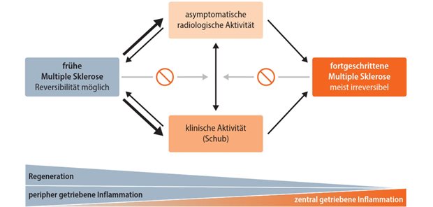 Abb. 1: MS-Krankheitsdynamik: Patientinnen und Patienten bewegen sich von frühen Stadien über Phasen fokaler Entzündung in fortgeschrittene, meist irreversible Stadien