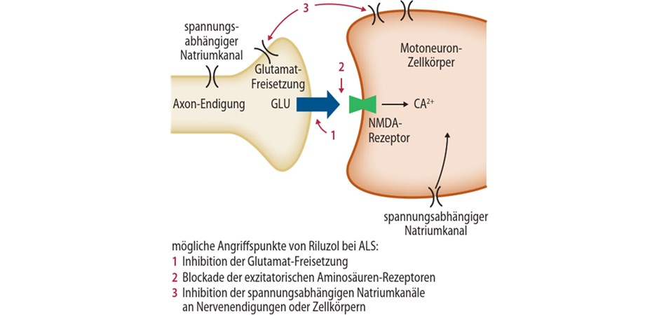 RiluzolSuspension vereinfacht die Therapie bei vielen Patienten