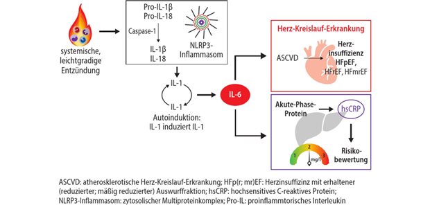 Abb. 1: Signalkaskade der kardiovaskulären Inflammation