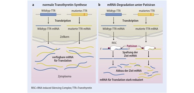 Abb. 1  Transthyretin-Synthese: a) physiologisch, b) unter Patisiran (nach [13])