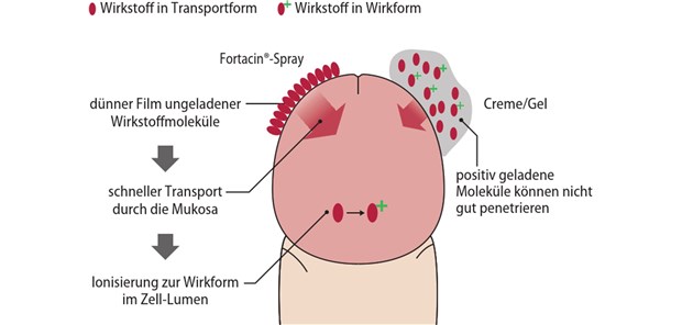 Abb. 1: Wirkmechanismus des Lidocain/Prilocain-Sprays (links) im Vergleich zu einer off label eingesetzten Creme mit beiden Lokalanästhetika (rechts)