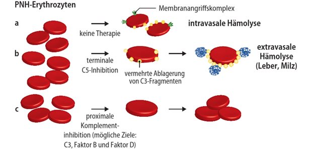 Abb. 1: Wirkung verschiedener Komplementinhibitoren auf die Hämolyse von PNH (paroxysmale nächtliche Hämoglobinurie)-Erythrozyten